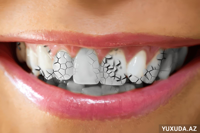 Yuxuda dişin qırılmasını görmək