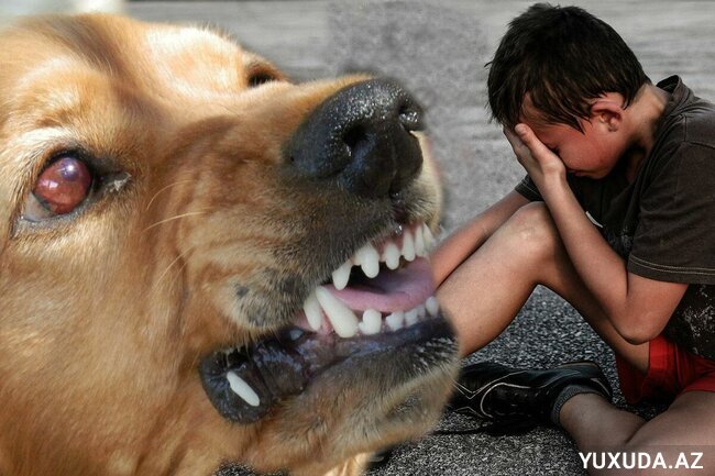 Yuxuda itin dişləməsini görmək