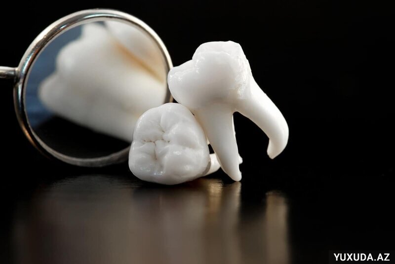 Yuxuda diş görmək